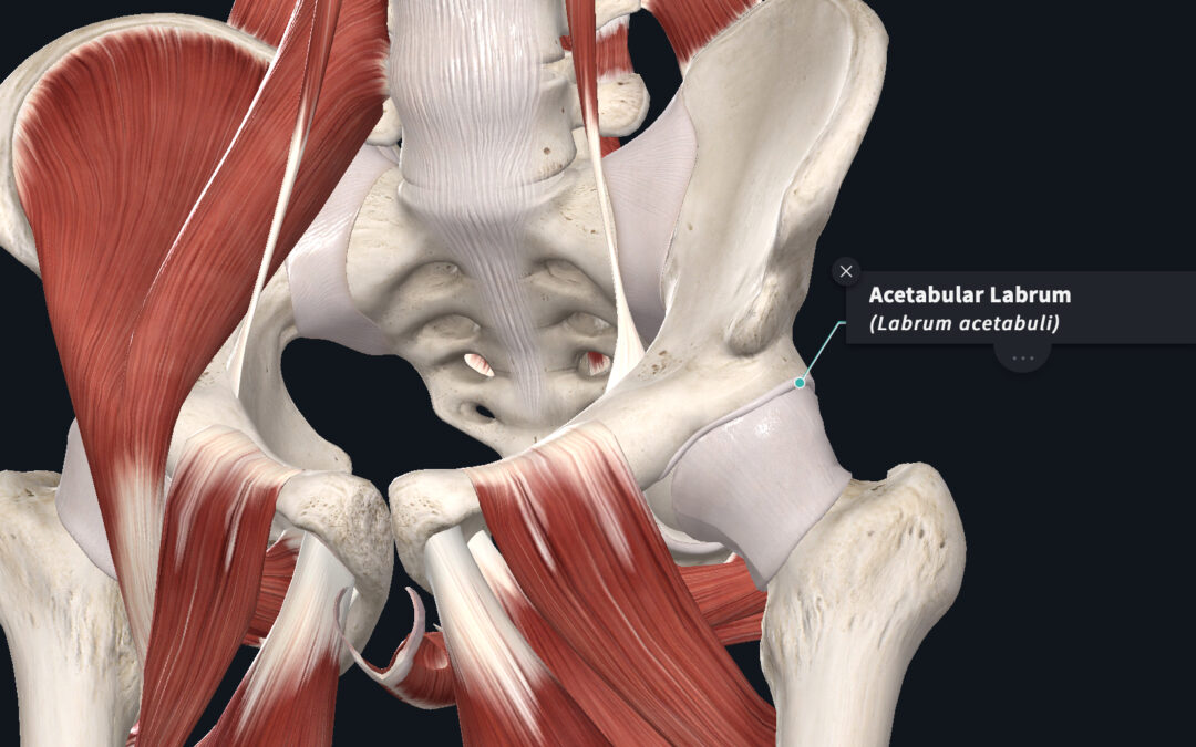 Hip Impingement | Dr. Abbate Physical Therapy