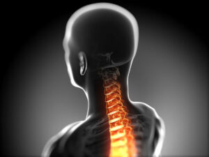 Whiplash Injury