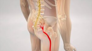 Sciatic nerve